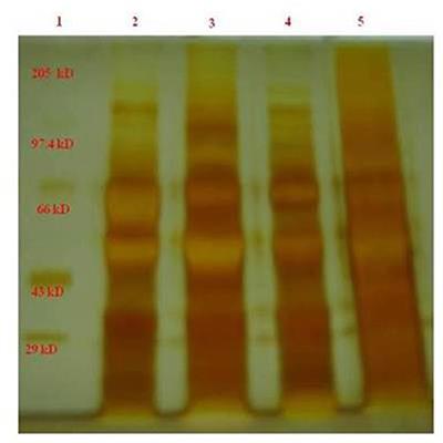 Identification and Structure Prediction of Human Septin-4 as a Biomarker for Diagnosis of Asthenozoospermic Infertile Patients—Critical Finding Toward Personalized Medicine